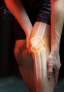 Orthopro 24 Prevent Knee Pain – Expert Advice Care