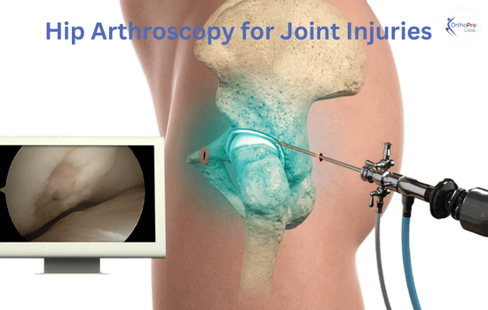 Hip Arthroscopy for Joint Injuries