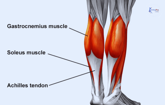 Achilles Tendon Repair 1 achilles tendon