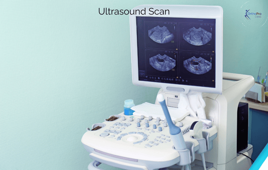 Ultrasound 1 Ultrasound Scan