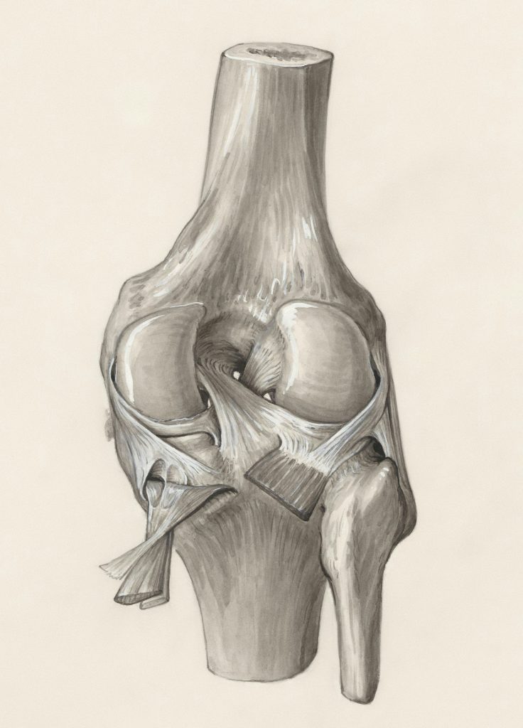 3The Outside Knee Conspiracy When Your IT Band Mimics a Meniscus Tear and How to Tell