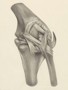 Acl Tears 2 orthopro ACL Tears