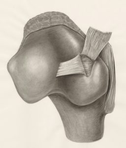 orthopro Pseudogout