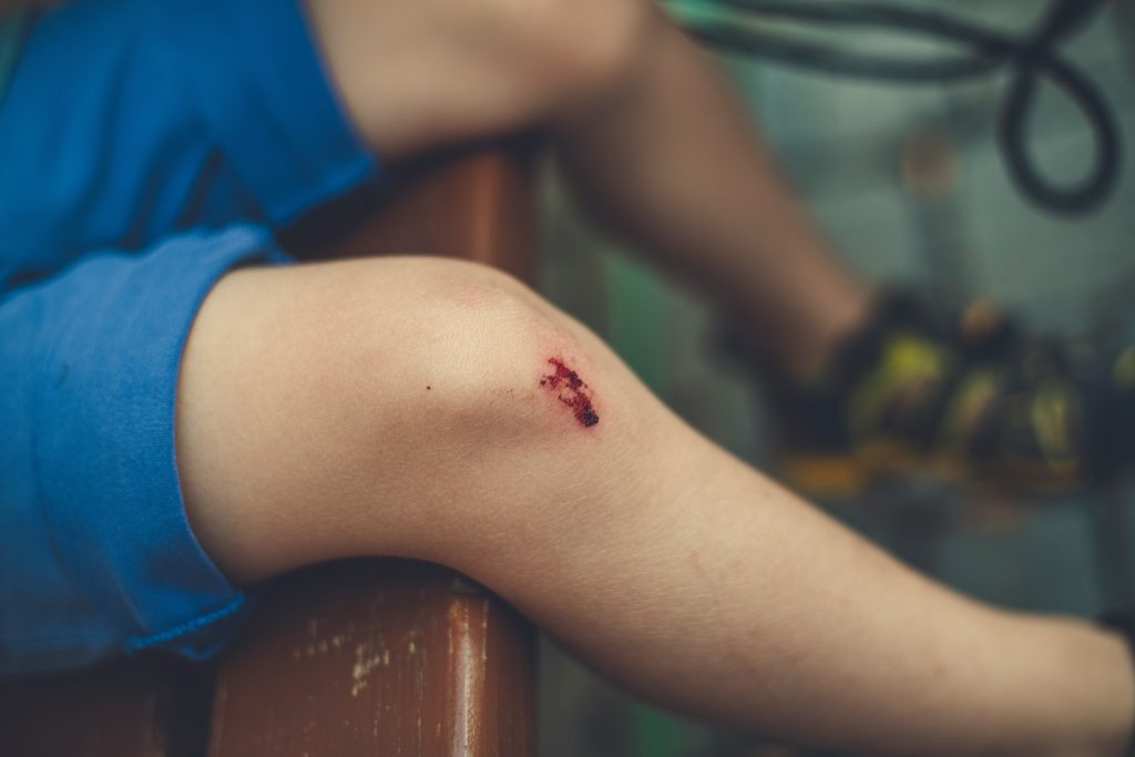 orthopro knee fracture