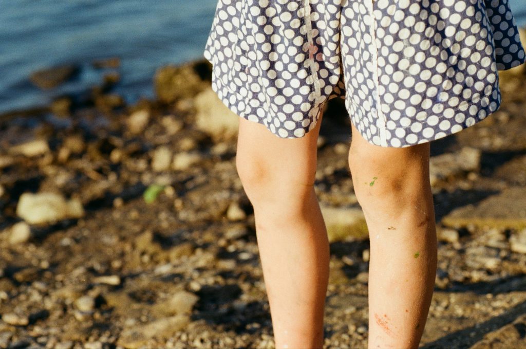 2How the Climate in Dubai Impacts Your Osteoarthritis Knee Treatment Plan