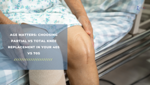 Age Matters_ Choosing Partial vs Total Knee Replacement in Your 40s vs 70s