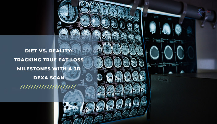Diet Vs. Reality_ Tracking True Fat Loss Milestones with a 3D DEXA Scan