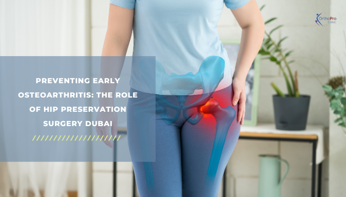 Advanced Imaging Centre Information Sheet 7 1Preventing Early Osteoarthritis_ The Role of Hip Preservation Surgery Dubai by Orthoproclinic