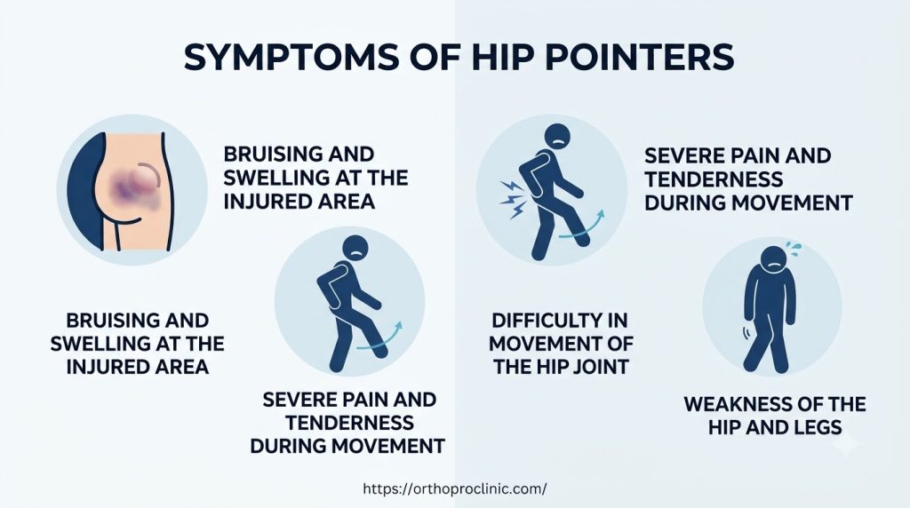 Symptoms of Hip Pointers